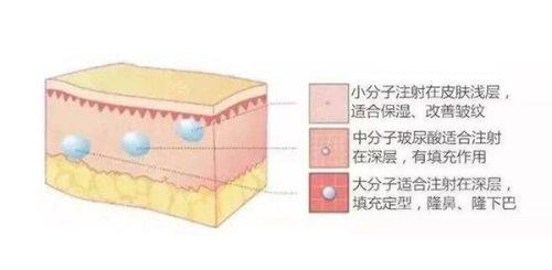 二、拆线后疤痕多久修复正常肤色