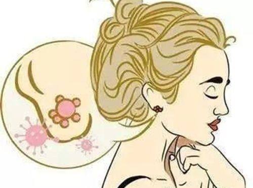 李援东医生擅长领域：