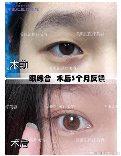 金在元医生技术优势