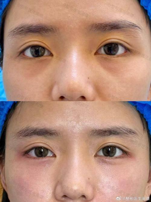 深圳博美医疗美容门诊部价格表