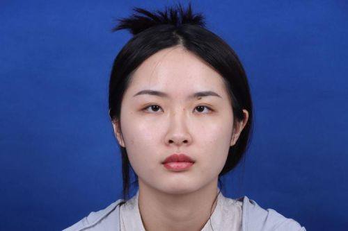 徐州云龙美玲医学美容诊所擅长项目