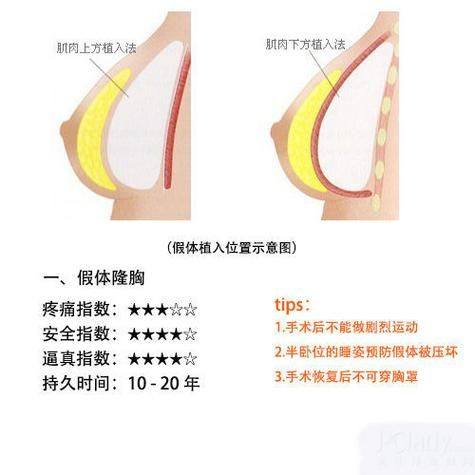 南平时光整形医疗美容门诊部价格表：