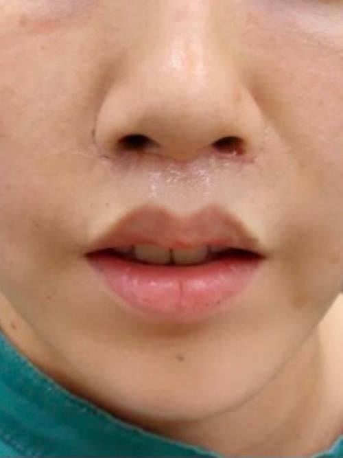 上海丽质整形医院预约挂号方式：