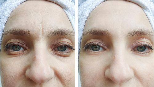 杭州芬迪医疗美容诊所怎么样口碑评价：