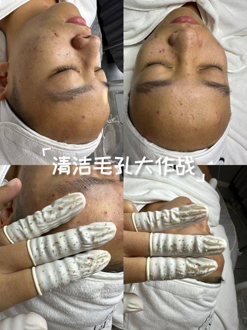 杭州芬迪医疗美容诊所怎么样价格表：