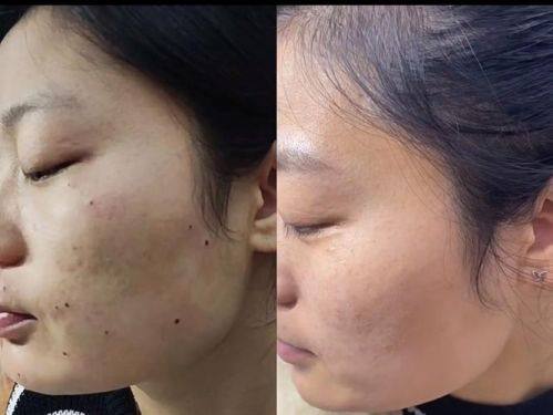 深圳博美医疗美容门诊部预约挂号方式