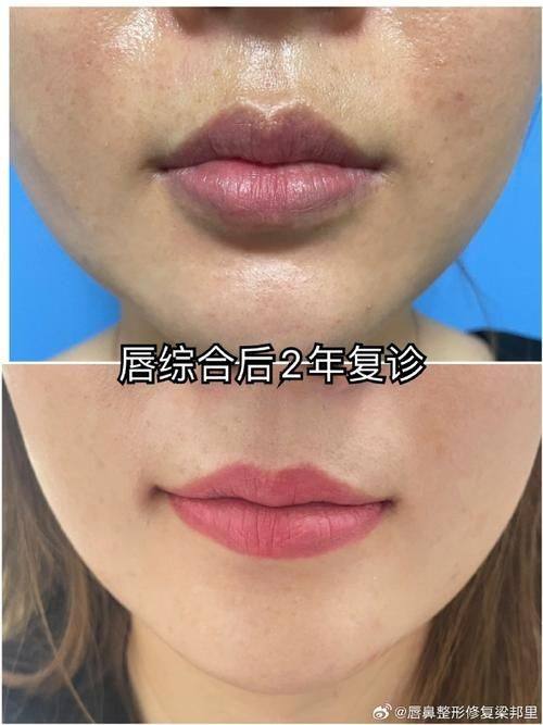 上海丽质整形医院地址电话及营业时间：