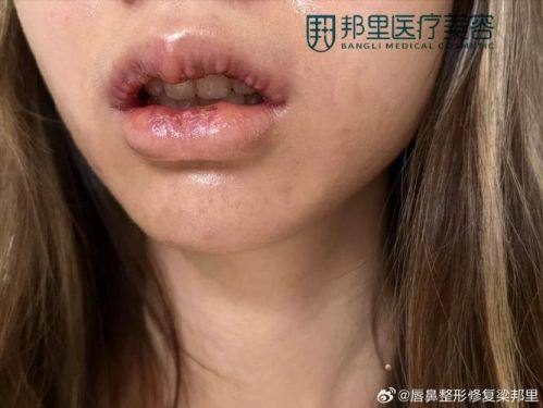 诺美医疗美容门诊部怎么样？