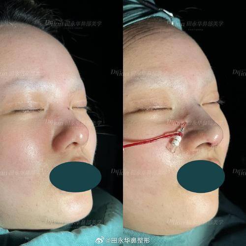 深圳博美医疗美容门诊部医生名单及擅长领域