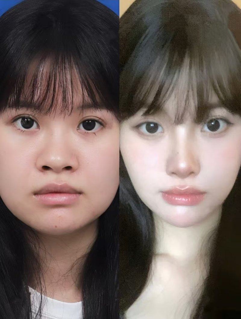 诺美医疗美容门诊部医生名单及擅长领域：