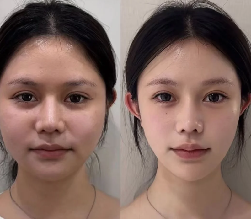 六、孩子眼袋大的常见认知误区