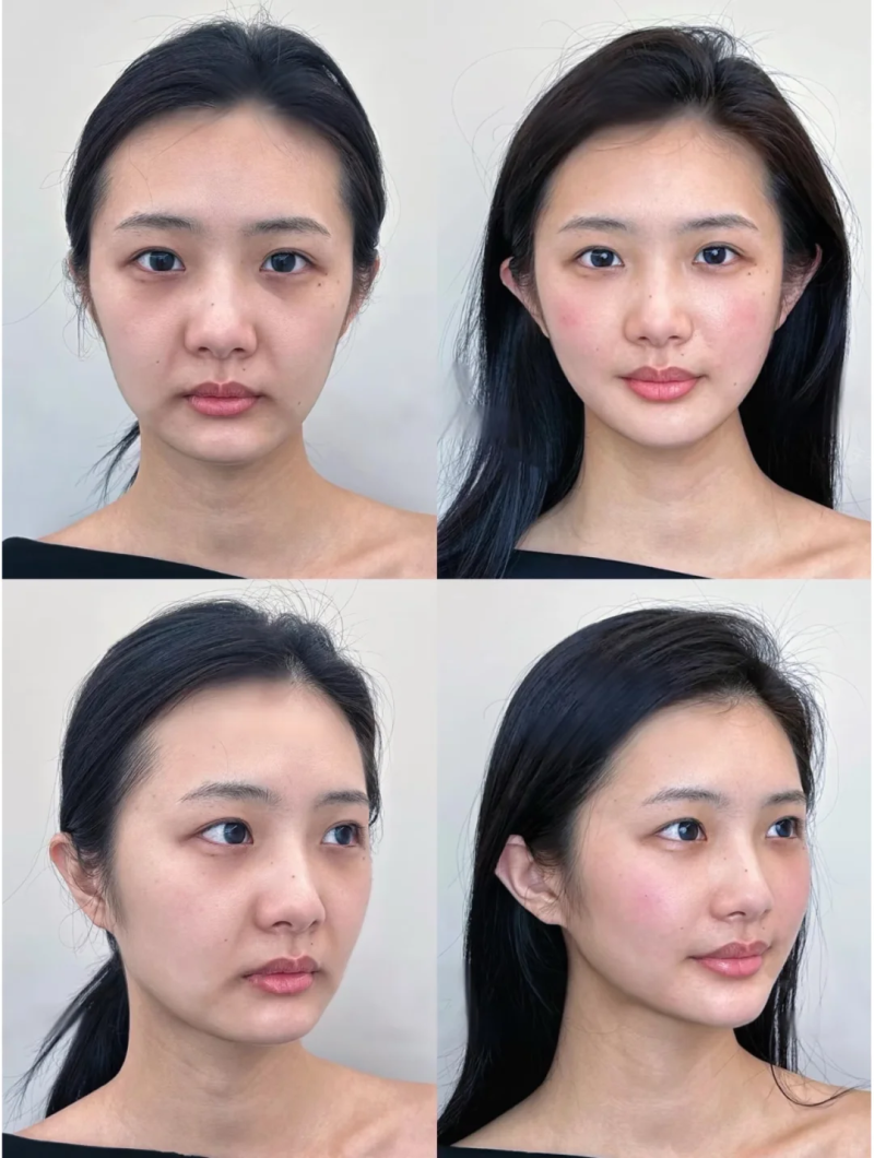 湛江市霞山区美杜莎医疗美容价格表：