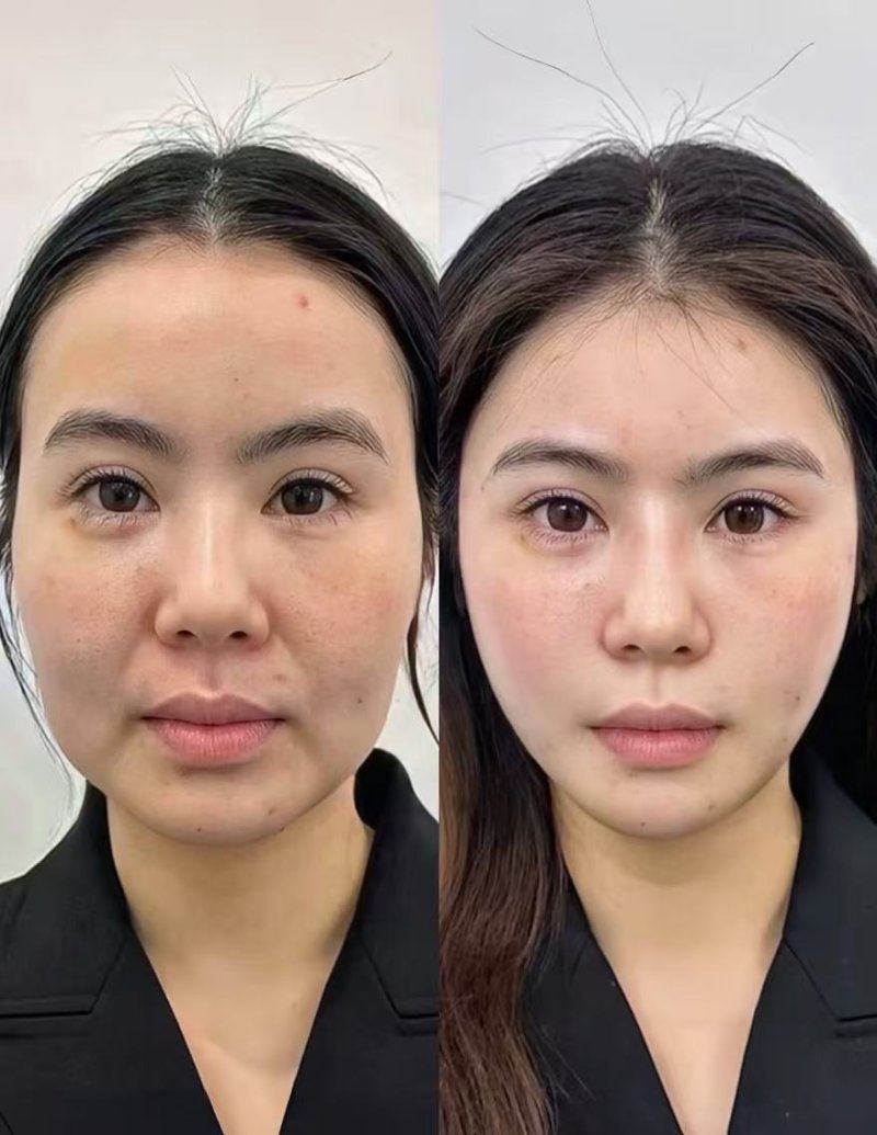 徐州云龙美玲医学美容诊所预约挂号方式