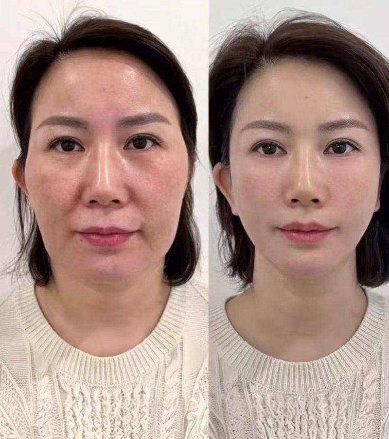 李援东医生口碑评价：