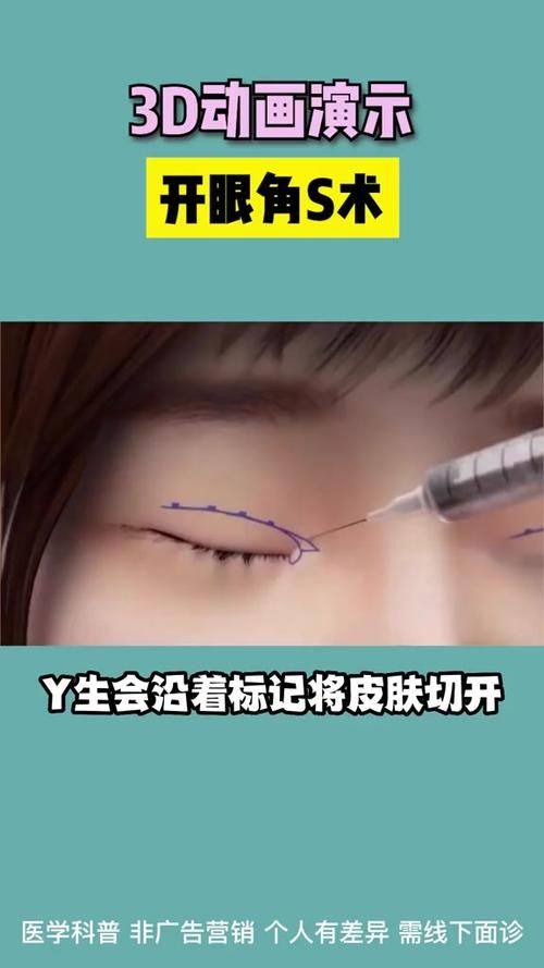 张丹阳医生技术优势：