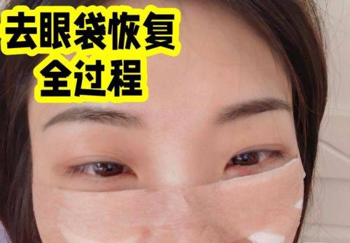 郑伟医生怎么预约