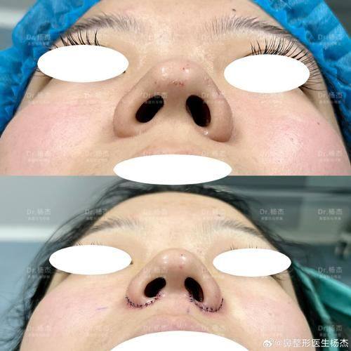 解放军第990医院整形美容外科（原159医院）预约挂号方式：