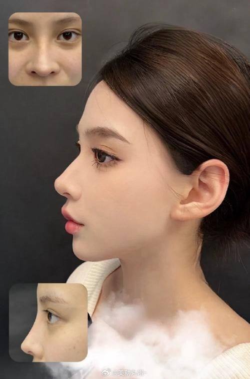 丁建平医生技术优势