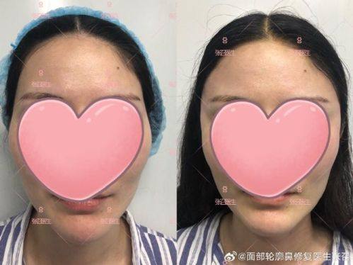 焦作东方好面相医疗美容诊所价格表：