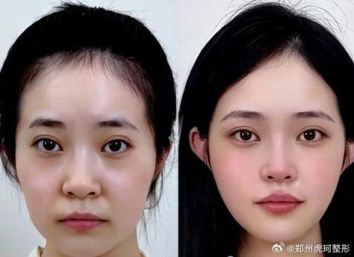 焦作东方好面相医疗美容诊所预约挂号方式：