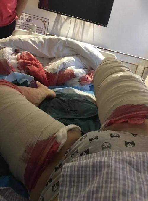 银川英涛医学整形美容诊所价格表