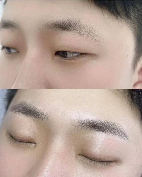 兰州新禾植发美容诊所擅长项目：