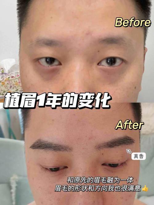 兰州新禾植发美容诊所价格表：