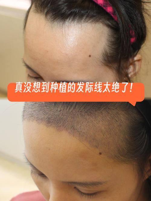 兰州新禾植发美容诊所医生名单及擅长领域：