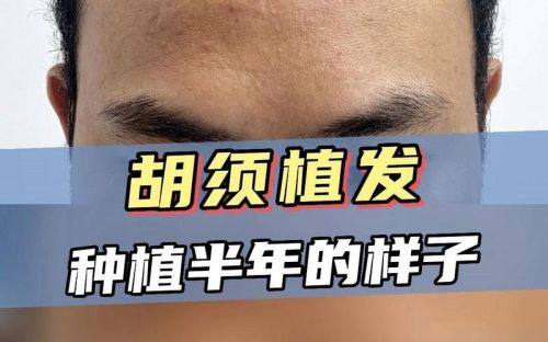 兰州新禾植发美容诊所预约挂号方式：