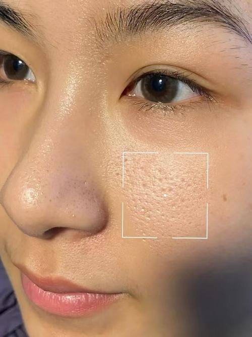 百色右江民族医学校附属医院烧伤整形外科医生名单及擅长领域