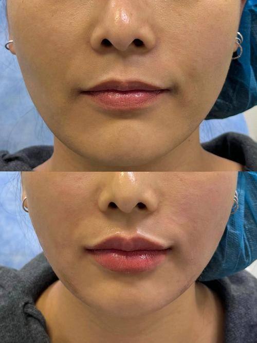 解放军第990医院整形美容外科（原159医院）地址电话及营业时间：