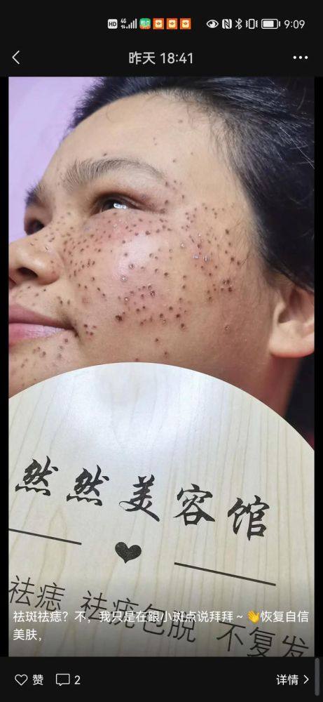 百色右江民族医学校附属医院烧伤整形外科价格表