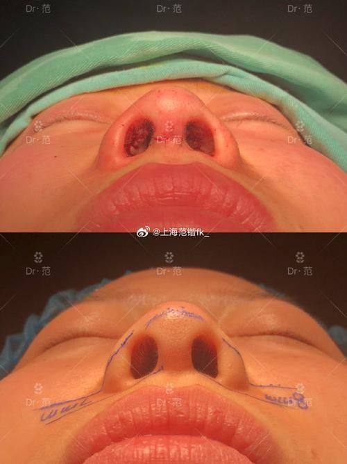 百色右江民族医学校附属医院烧伤整形外科擅长项目