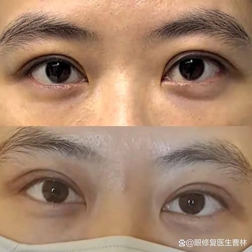 郑伟医生技术优势