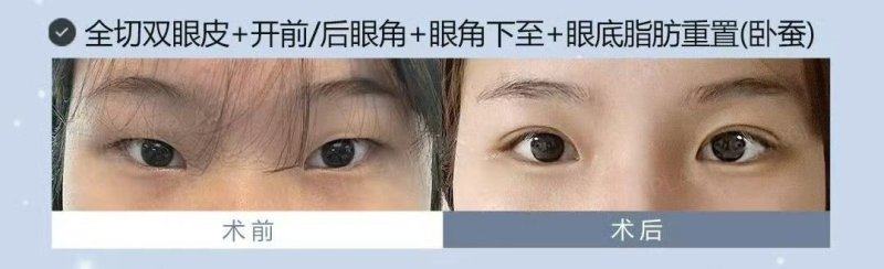 南昌颜咖华韩整形医院口碑评价：