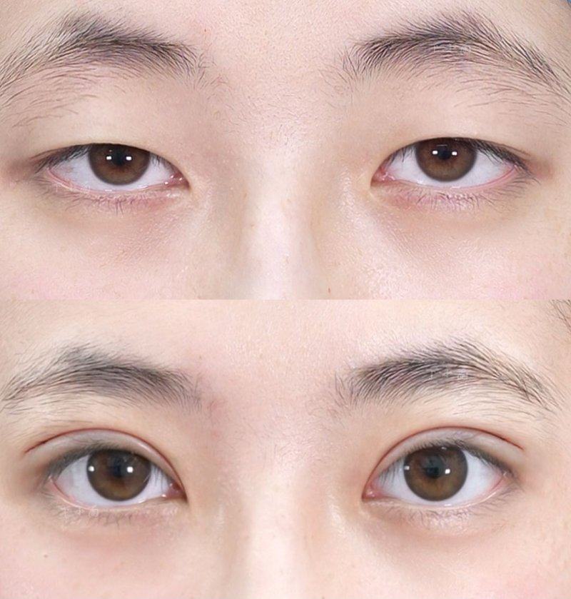 韩国灵气AURA整形医院怎么样？