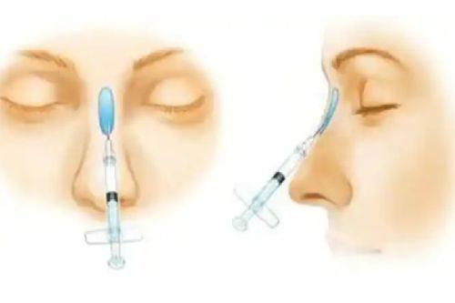 二、假体隆胸：规范放置位置，不触碰乳腺组织