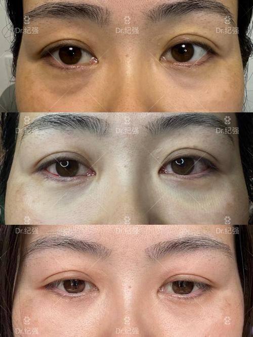 重庆妮杨丝医疗美容诊所擅长项目