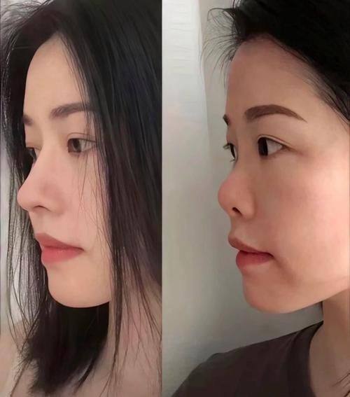 重庆妮杨丝医疗美容诊所口碑评价