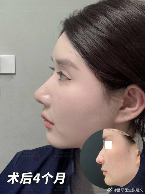 湖南株洲星薇美医疗美容门诊部怎么样?