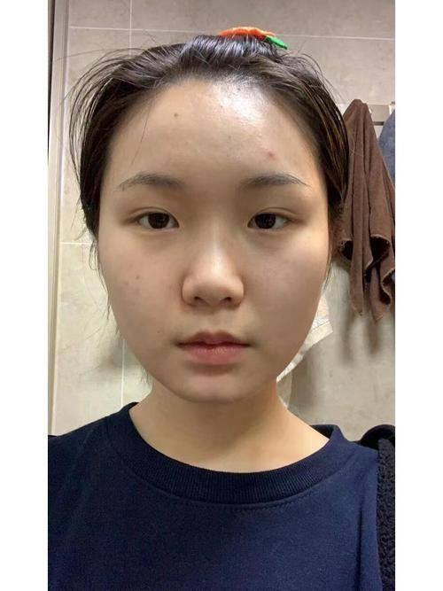 佛山雍禾植发整形外科门诊部口碑评价：