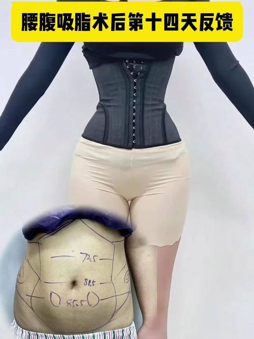 石家庄润美医疗美容门诊部医生名单及擅长领域