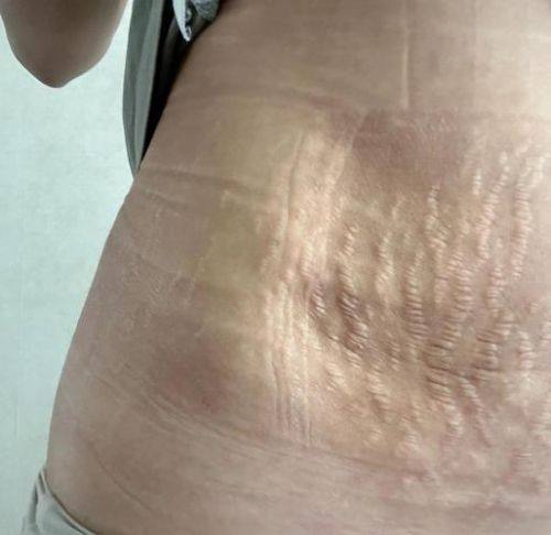 石家庄润美医疗美容门诊部预约挂号方式