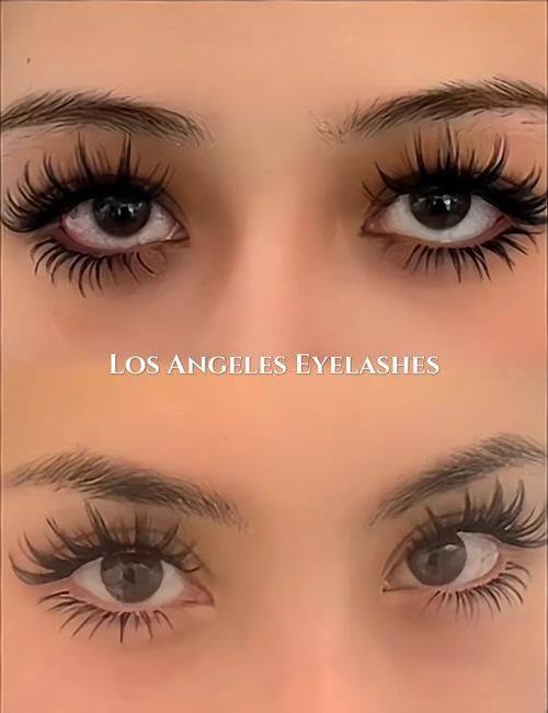 西安沐森植发怎么样？