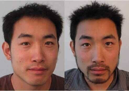 西安沐森植发地址电话及营业时间