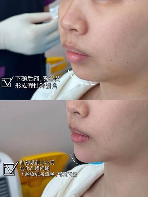 石家庄润美医疗美容门诊部地址电话及营业时间