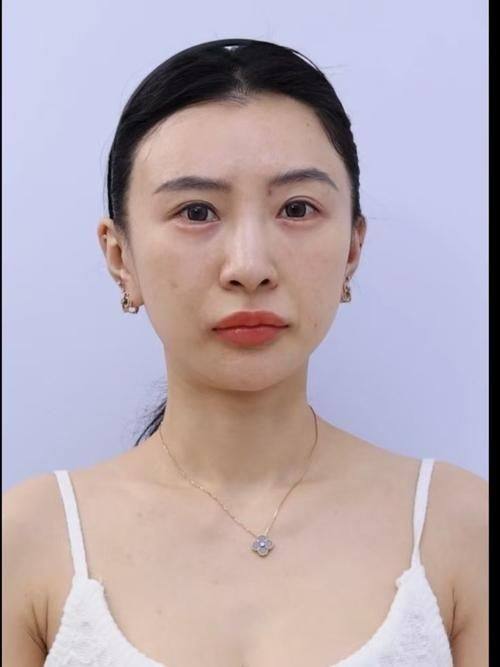 石家庄润美医疗美容门诊部擅长项目