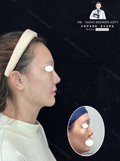 石家庄润美医疗美容门诊部怎么样