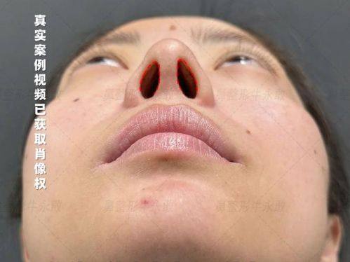 重庆丽格整形美容医院价格表：