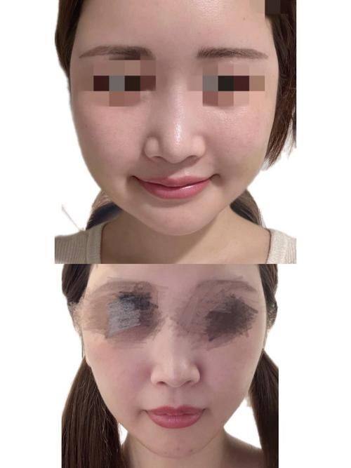 无锡可琳雅医疗整形医院预约挂号方式